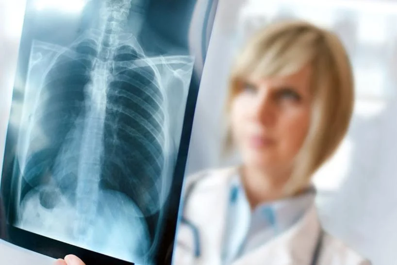 Вносятся изменения в график работы кабинетов флюорографии и рентгенографии поликлинического отделения № 1