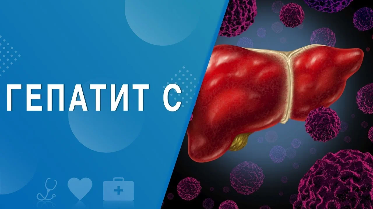 Гепатит С в вопросах и ответах